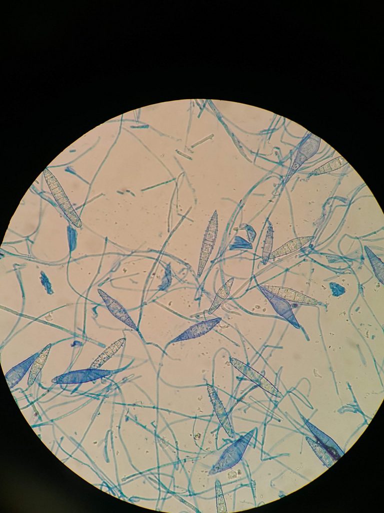 schimmel microscopie